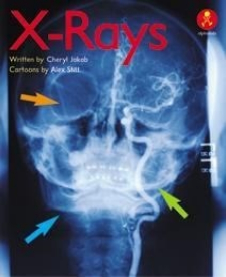 Picture of Ak+ L18: X-Rays