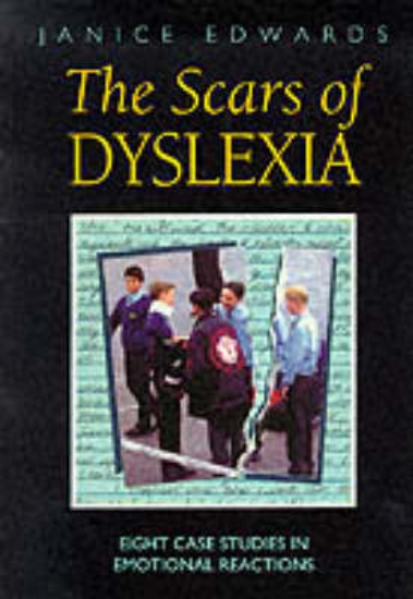 Picture of The Scars of Dyslexia